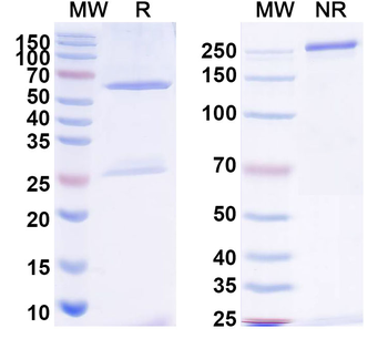 Influenza B virus HA/Hemagglutinin Human Monoclonal Antibody