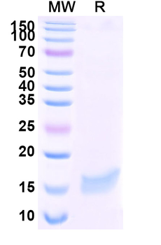 Influenza A virus RNA polymerase complex Camelus Monoclonal Antibody