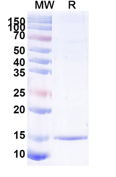 ALB Camelus Recombinant Antibody