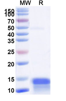 CALCA/Calcitonin Camelus Monoclonal Antibody