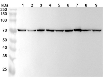 HSPA9/Mortalin/GRP75 Mouse Monoclonal Antibody