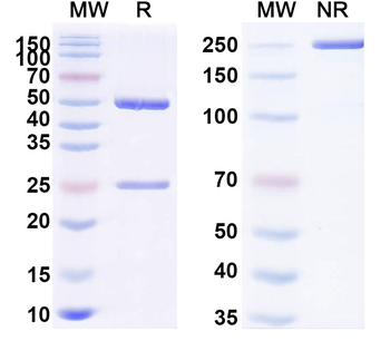Gluten Human Monoclonal Antibody