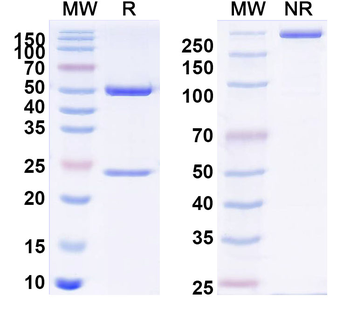 PHLPV/Allergen Phl p V Human Monoclonal Antibody