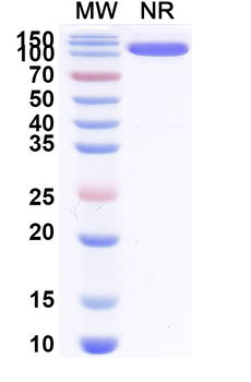 Bet v 1/Allergen Bet v I-A Human Monoclonal Antibody