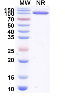 Bet v 1/Allergen Bet v I-A Human Monoclonal Antibody