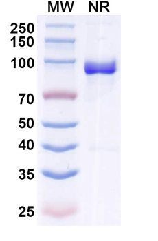 Bet v 1/Allergen Bet v I-A Human Monoclonal Antibody