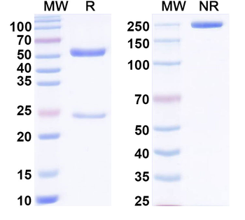 Bet v 1/Allergen Bet v I-A Human Monoclonal Antibody