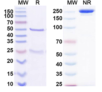 Bet v 1/Allergen Bet v I-A Human Monoclonal Antibody