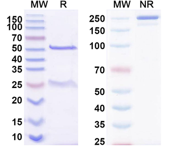 Bet v 1/Allergen Bet v I-A Human Monoclonal Antibody