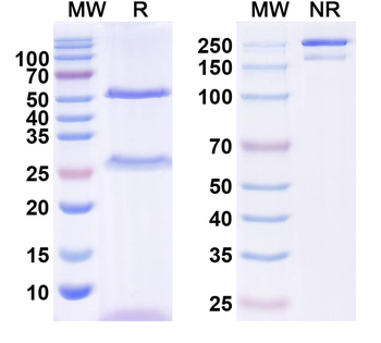 CD122/IL2RB Mouse Monoclonal Antibody