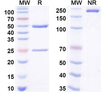 OSM/Oncostatin-M Human Monoclonal Antibody
