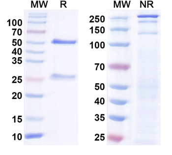 IL6 Human Monoclonal Antibody
