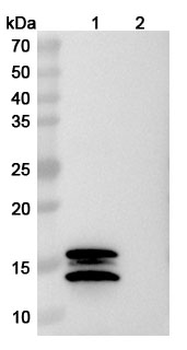 IL2 Mouse Monoclonal Antibody