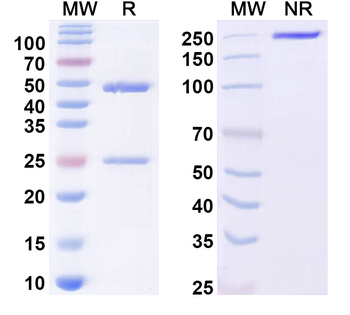 MMP7 Mouse Monoclonal Antibody