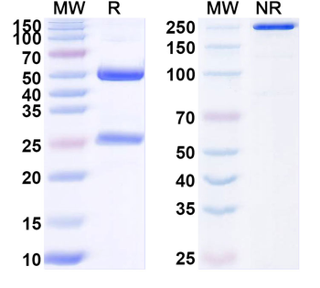 RSV F/Fusion glycoprotein F0 Mouse Monoclonal Antibody