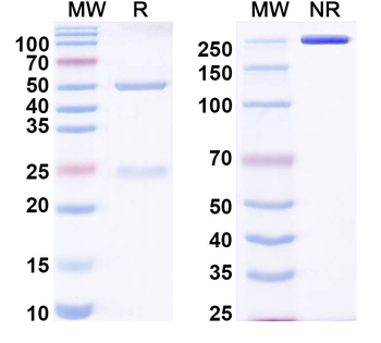 TIMP2 Mouse Monoclonal Antibody