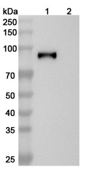 EBV/HHV-4 gH/BXLF2 Human Recombinant Antibody