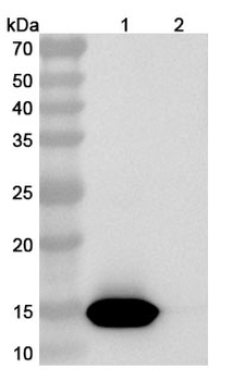Phleum pratense PHLPII/Phlp2 Human Monoclonal Antibody