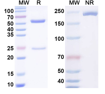 BVDV Envelope glycoprotein E2/gp55 Mouse Monoclonal Antibody