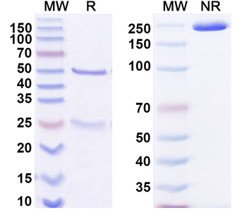 Transthyretin amyloidosis Mouse Monoclonal Antibody