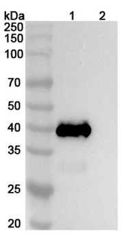 CHIKV Spike glycoprotein E2 Human Monoclonal Antibody