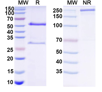 HCV NS1/gp68/gp70/Envelope glycoprotein E2 Human Monoclonal Antibody