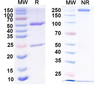 HPV16 L1/Major capsid protein L1 Mouse Recombinant Antibody