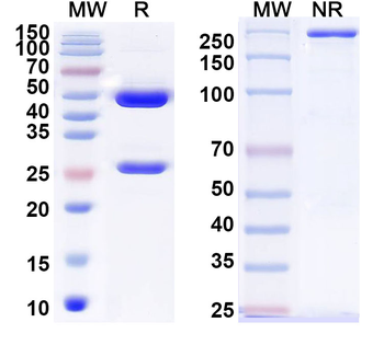TSHR Mouse Recombinant Antibody