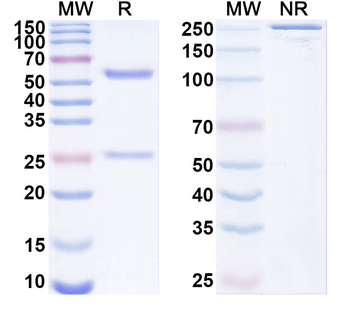 SARS-CoV-2 NP/Nucleoprotein Human Monoclonal Antibody