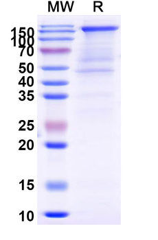 Recombinant SARS-CoV-2 S - Trimer (WT), C-His