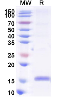 Recombinant HCoV-OC43 M/Membrane protein Protein, N-His