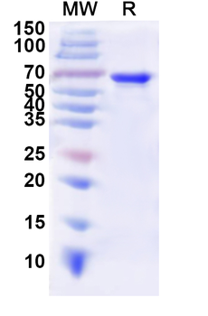 Recombinant Influenza B virus (Flu B) NP/Nucleoprotein Protein, N-His