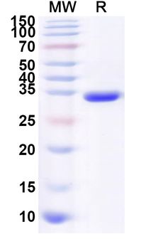 Recombinant Influenza A virus (H8N4) HA/Hemagglutinin Protein, N-His