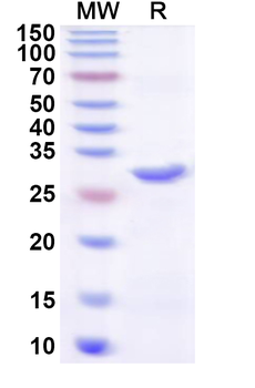 Recombinant Influenza A virus (H7N7) HA/Hemagglutinin Protein, N-His