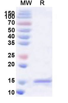 Recombinant HCoV-229E M/Membrane protein Protein, N-His