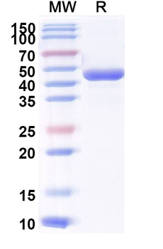 Recombinant Human IL4 Protein, N-mFc