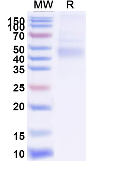 Recombinant EBV/HHV-4 gH/BXLF2 Protein, C-His
