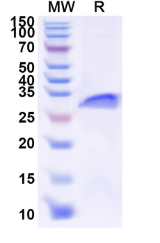 Recombinant Human EREG Protein, N-GST & C-His
