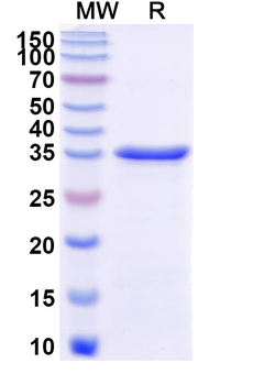 Recombinant Human USP47 Protein, N-His