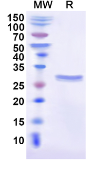 Recombinant Human USP31 Protein, N-His