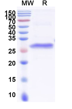 Recombinant Human COL1A1 Protein, N-His