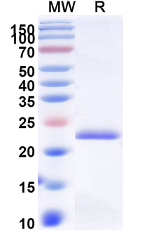 Recombinant Human GGCT Protein, N-His