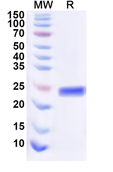 Recombinant Human CD367/CLEC4A Protein, N-His