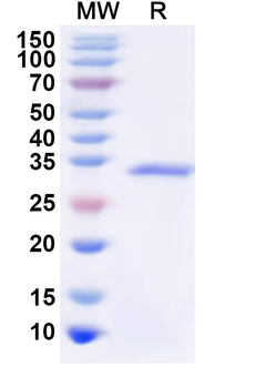 Recombinant Human CD360/IL21R Protein, N-His