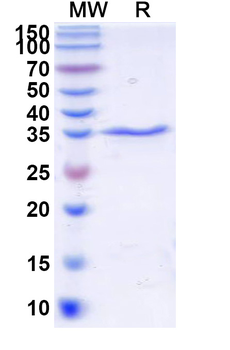 Recombinant E. coli O157:H7 FliC/Flagellin Protein, N-His