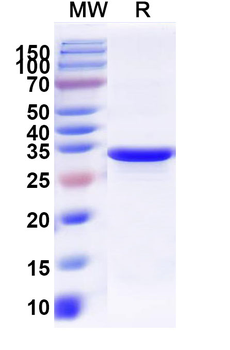 Recombinant Salmonella typhimurium murE Protein, N-His