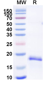 Recombinant Mouse MYDGF Protein, N-His