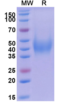 Recombinant Human CD200 Protein, C-His