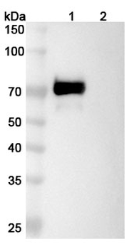 Recombinant Human AFP/Alpha-fetoprotein Protein, C-His