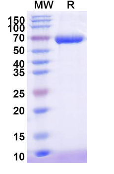 Recombinant Human AFP/Alpha-fetoprotein Protein, C-His